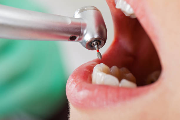 Best Emergency Gum Treatment in New Cassel, NY